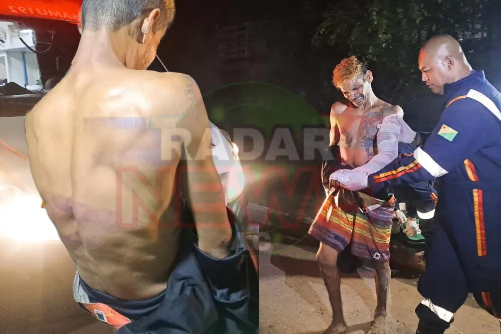 Homem em situação de rua é brutalmente espancado em Rio Branco.
