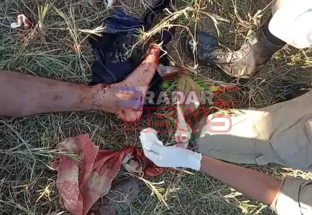 Colono quase é morto em ataque de jacaré enquanto realizavam pescaria na zona rural.