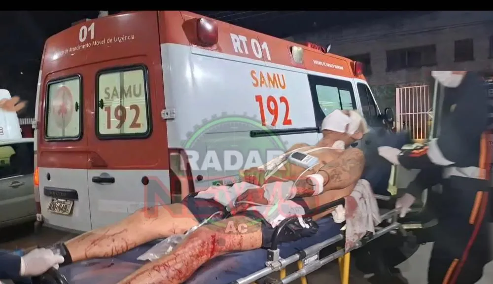 Monitorado por tornozeleira eletrônica e vítima de tentativa de hominicídio por terçado em rio branco 